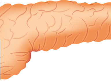 Te objawy mogą wskazywać na raka trzustki 
